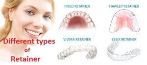 Retainer: What is It, Types, Cost, Benefits, drawback you must know ...